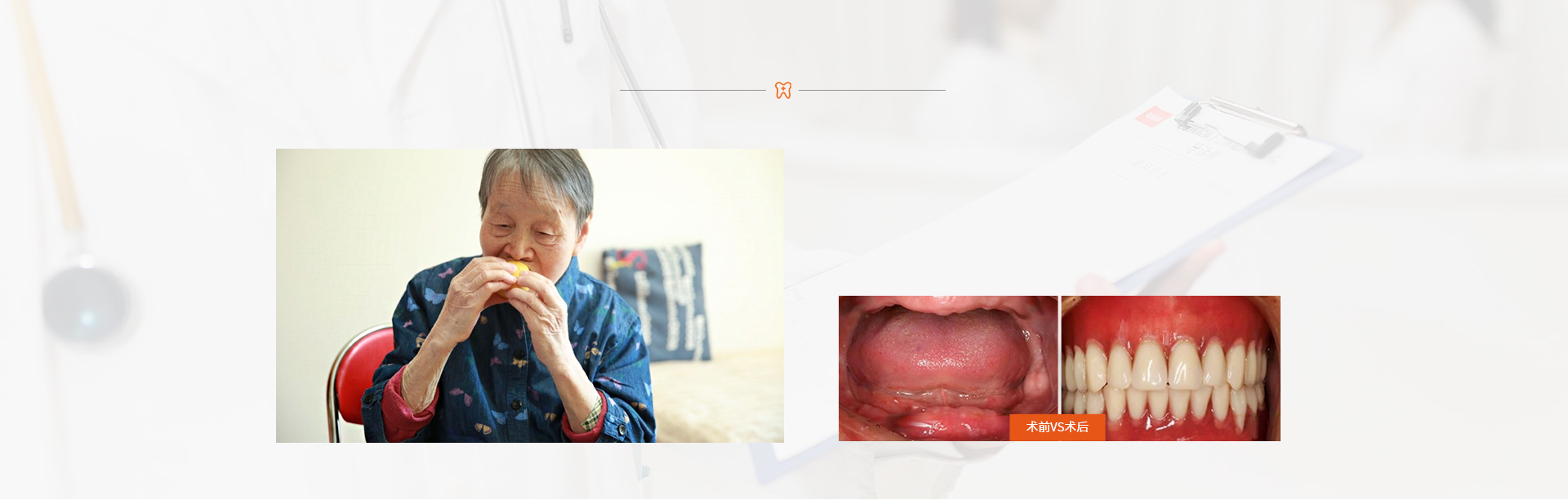 王丁元医生修复前后对比